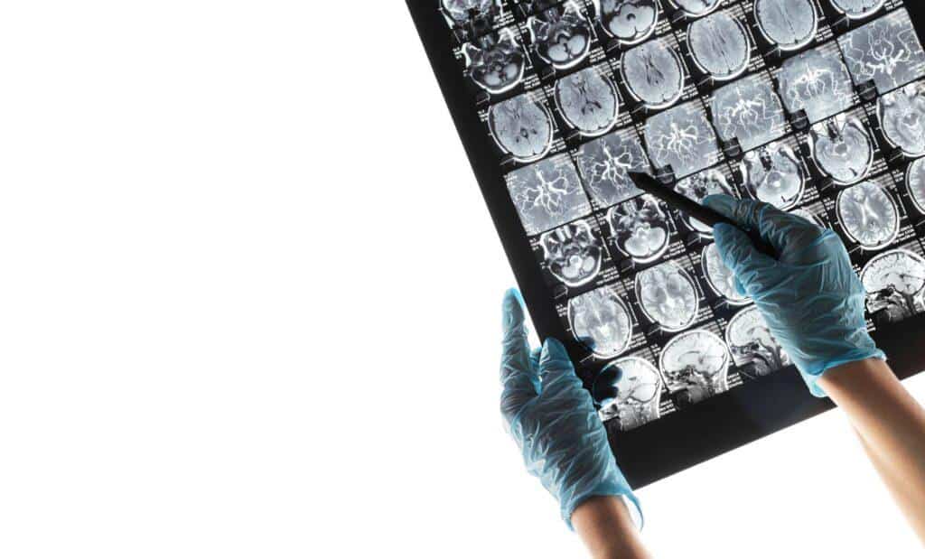 Bilgisayarlı Tomografi