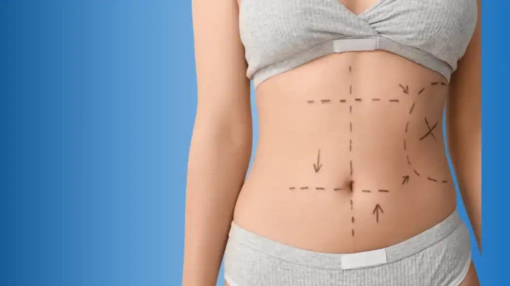 Karin Germe Ameliyatı Nedir