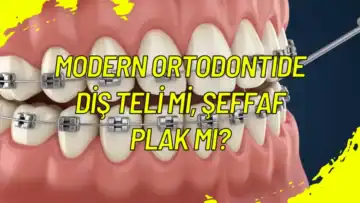 Modern Ortodontide Dİş Telİ