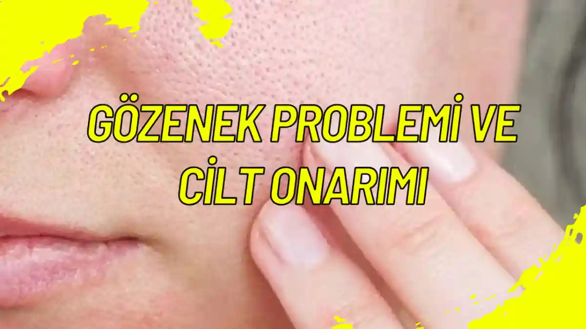 Gözenek Problemi ve Cilt Onarımı